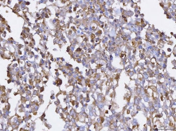 BCAT1 Antibody