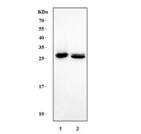 Western blot testing of 1) human HEL and 2) rat spleen tissue lysate with Carbonic Anhydrase I antib