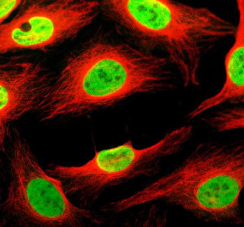 Immunofluorescent staining of THYN1 using anti-THYN1 antibody (green) and anti-Alpha Tubulin antibod
