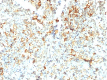 IHC staining of FFPE human testicular cancer with FCGRT antibody (clone FCGRT/2932). HIER: boil tiss