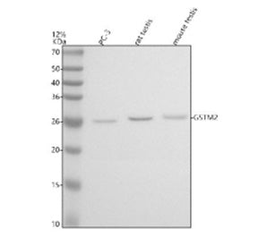 Western blot analysis of GSTM2 using anti-GSTM2 antibody. Electrophoresis was performed on a 12% SDS