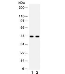 Western blot testing of 1) rat skeletal muscle and 2) mouse skeletal muscle lysate with SGCA antibod
