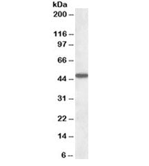 Western blot testing of human liver lysate with AADAT antibody at 1ug/ml. Predicted molecular weight