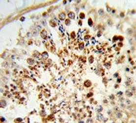 IHC testing of FFPE human testis tissue with COX6A1 antibody. HIER: steam section in pH6 citrate buf