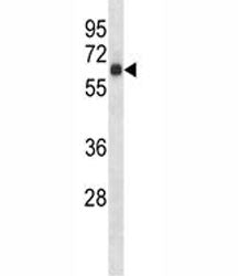 S6k1 antibody western blot analysis in mouse heart tissue lysate. Predicted molecular weight: 60-70 