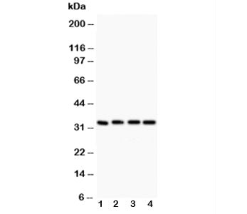 Western blot testing of Caspase-3 antibody (0.5ug/ml) and Lane 1: rat liver; 2: MCF-7; 3: SMMC-7721;