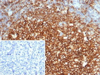IHC staining of FFPE human tonsil tissue with CD73 antibody (clone NT5E/4679). Inset: PBS used in pl