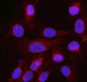 Profilin 3 Antibody / PFN3
