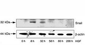 HepG2 cells were incubated with HGF for the indicated time periods. LiCl and MG132 were added 8 hr b