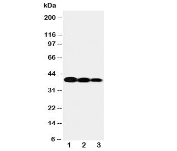 Western blot testing of IL12 p40 antibody and Lane 1: recombinant human protein 10ng; 2: 5ng; 3: 2.5