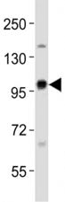 Western blot testing of EZH2 antibody at 1:1000 dilution + rat C6 lysate; Predicted size : 85-95 kDa
