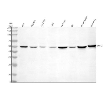 Western blot analysis of SYT12 using anti-SYT12 antibody. Electrophoresis was performed on a 10% SDS