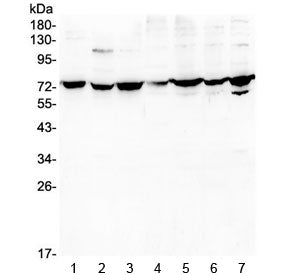 Western blot testing of human 1) A431, 2) K562, 3) A549, 4) PC-3, 5) U-2 OS, 6) Caco-2 and 7) HEK293