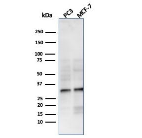 Western blot testing of human PC-3 and MCF-7 cell lysate with NKX2.8 antibody. Predicted molecular w