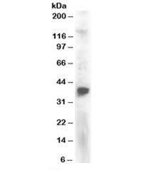 Western blot testing of Jurkat lysate with PINX antibody at 2ug/ml. Predicted molecular weight: ~37k
