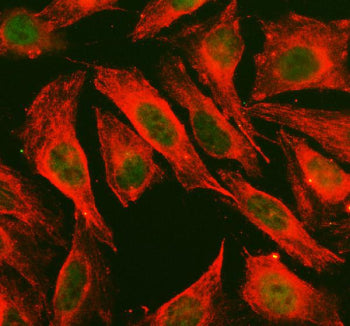 Western blot testing of 1) rat kidney, 2) human HeLa, and 3) human A549 lysate with SAPK4 antibody. 