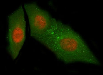 Immunofluorescent staining of FFPE human HeLa cells with NUB1 antibody (red) and Beta Tubulin mAb (g