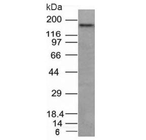 Western blot analysis of human HCT116 cell lysate using CD56 antibody. Predicted molecular weight: ~