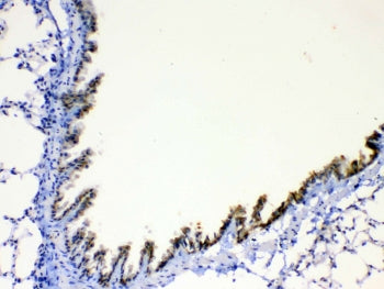 IHC testing of FFPE mouse lung tissue with AGRP antibody at 1ug/ml. Required HIER: steam section in 