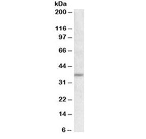 Western blot testing of rat adipose lysate with UCP2 antibody at 1ug/ml. Predicted molecular weight 