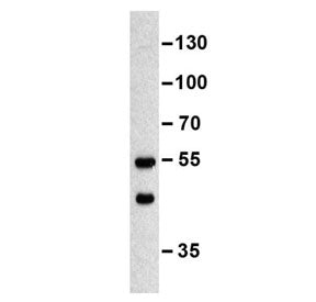 Western blot testing of murine erythroleukemia cell lysate with MINPP1 antibody. Predicted molecular