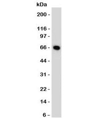 MCF7 cells western blot tested with Estrogen Receptor antibody (ER505). Predicted molecular weight ~