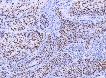 MSH2 Antibody