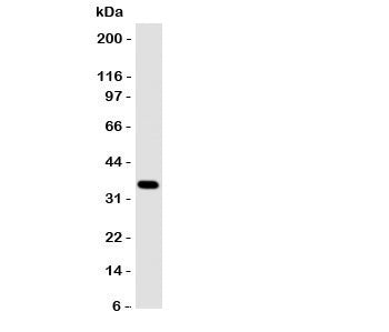 Western blot testing of Annexin A10 antibody and A549 cell lysate. Predicted molecular weight: ~36kD