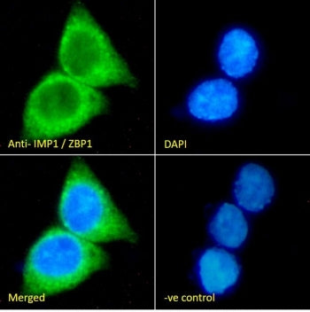 IF/ICC staining of fixed and permeabilized human HepG2 cells with ZBP-1 antibody (green) at 10ug/ml 