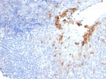 IHC staining of FFPE human prostate tissue with recombinant CD10 antibody (clone MME/6696R). HIER: b