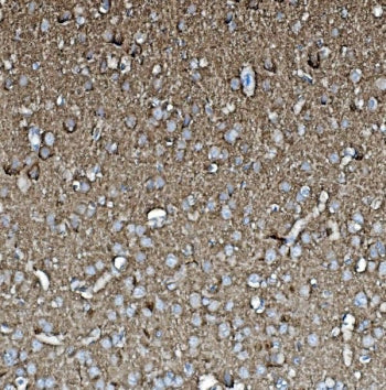 IHC staining of FFPE rat brain with GAP43 antibody. HIER: boil tissue sections in pH8 EDTA for 20 mi