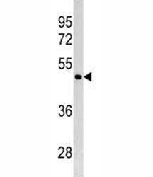 GATA4 Antibody