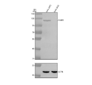 Western blot analysis of PARP1 using anti-PARP1 antibody. Electrophoresis was performed on a 8% SDS-