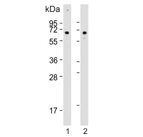 Western blot testing of human 1) HeLa and 2) U-2 OS cell lysate with CLEC4F antibody. Predicted mole