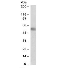 Western blot testing of human hippocampus lysate with MAOB antibody at 0.5ug/ml. Predicted/observed 
