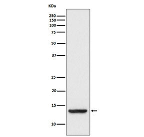 Western blot testing of human HT-1080 cell lysate with TAX1BP3 antibody. Predicted molecular weight 