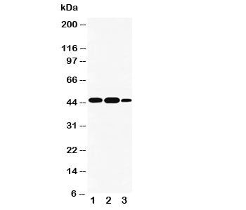 Western blot testing of INDOL1 antibody and Lane 1: human A549; 2: human placenta; 3: human A431 cel