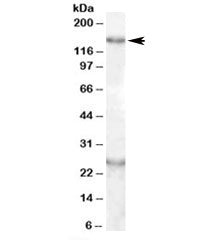 Western blot testing of mouse brain lysate with KIAA0319 antibody at 0.5ug/ml. Both the expected ~15
