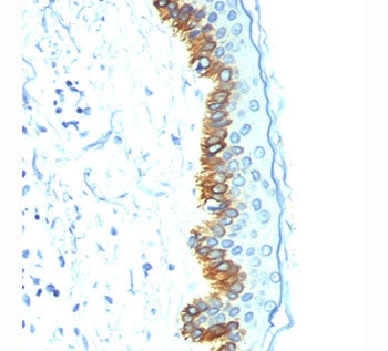 Acidic Cytokeratin Antibody (LMW / Type I)