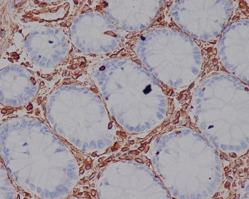 IHC staining of FFPE human colon tissue with VIM antibody. HIER: boil tissue sections in pH6, 10mM c