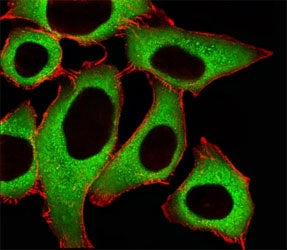 Fluorescent image of A549 cells stained with ALDH1A1 antibody at 1:25. An Alexa Fluor 488-conjugated