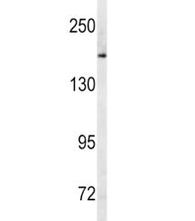 Western blot analysis of MRP1 antibody and human Ramos lysate. Predicted molecular weight: 152-172 k