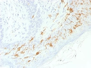 IHC testing of FFPE human skin with recombinant CD1a antibody (clone C1A/1506R). Required HIER: boil