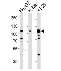 Western blot analysis of lysate from HepG2, human liver, HT-29 cell line (left to right) using HGFR 