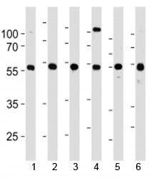 YY1 antibody western blot analysis in 1) 293, 2) HL-60, 3) SiHa, 4) K562, 5) THP-1 and 6) U266 lysat