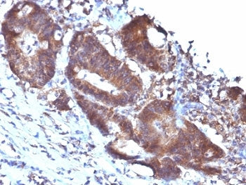 SM22 alpha Antibody / Transgelin