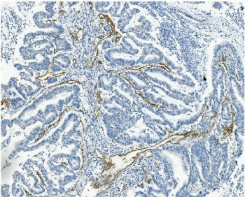CD146 Antibody / MCAM / MUC18