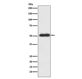 Western blot testing of human SH-SY5Y cell lysate with SLIT2 antibody. Expected molecular weight: ~1