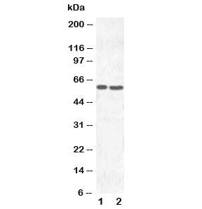 Western blot testing of SLC22A6 antibody and Lane 1: HT1080; 2: HeLa cell lysate