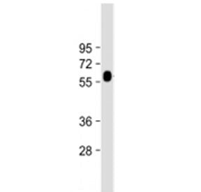 Western blot testing of GGT3P antibody at 1:2000 + human kidney lysate. Predicted molecular weight ~